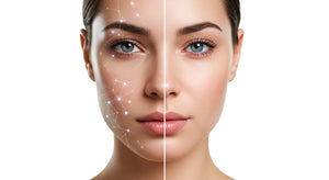 Face Look Tired Even After a Good Night's Sleep? Causes and Solutions for 'Skin Slump'